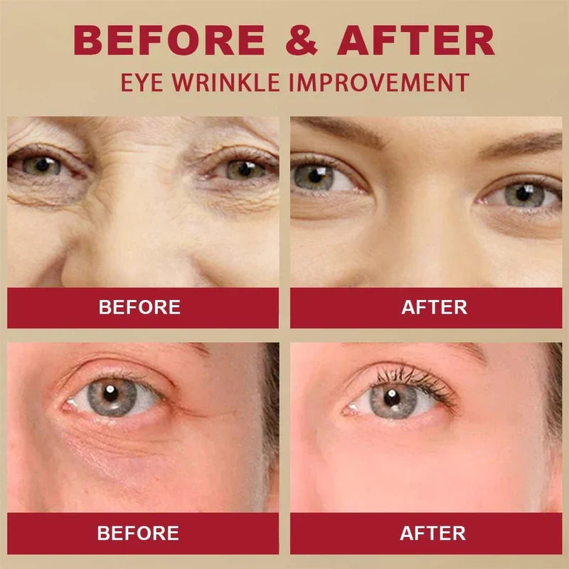 SEOUL 1988 Eye Cream – Retinal Liposome 4% + Fermented Bean | Anti-Wrinkle & Brightening Eye Care