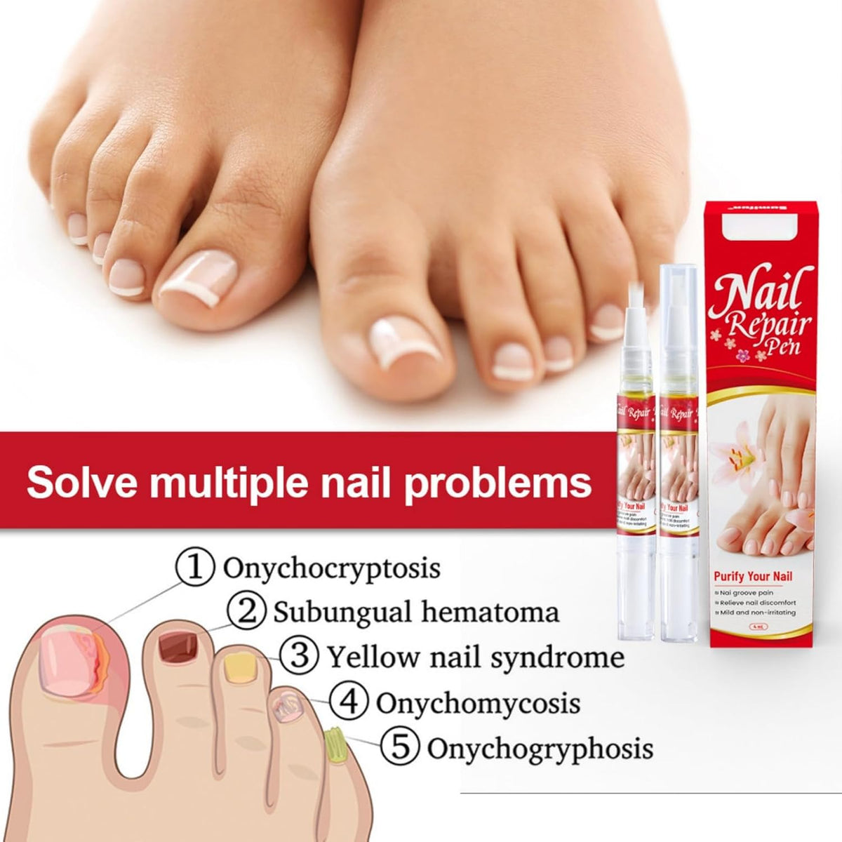 Nail Repair Pen
