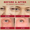 SEOUL 1988 Eye Cream – Retinal Liposome 4% + Fermented Bean | Anti-Wrinkle & Brightening Eye Care