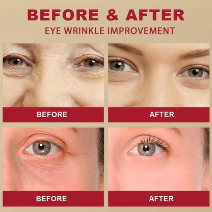SEOUL 1988 Eye Cream – Retinal Liposome 4% + Fermented Bean | Anti-Wrinkle & Brightening Eye Care