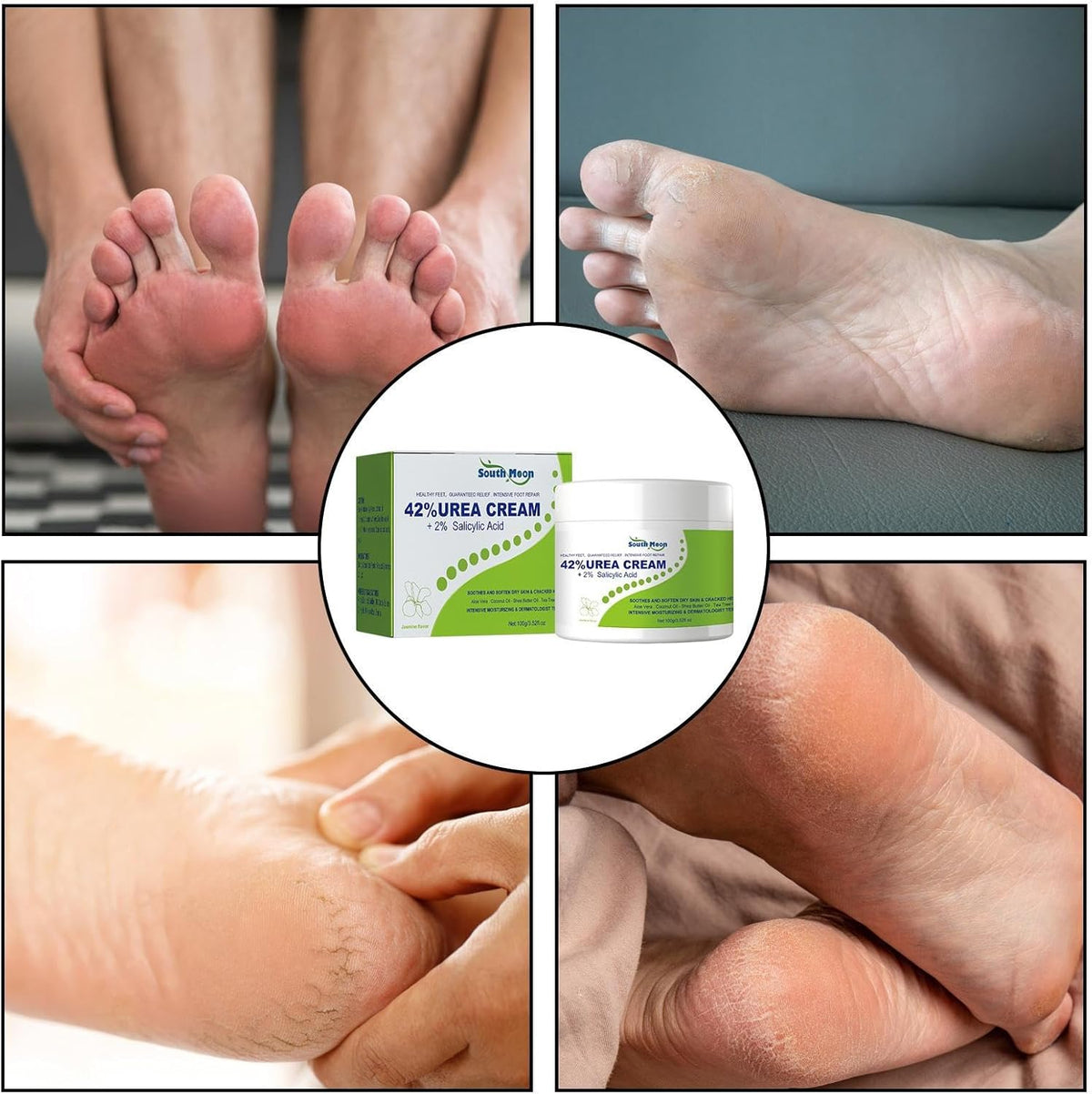 South Moon - 42% Urea Cream